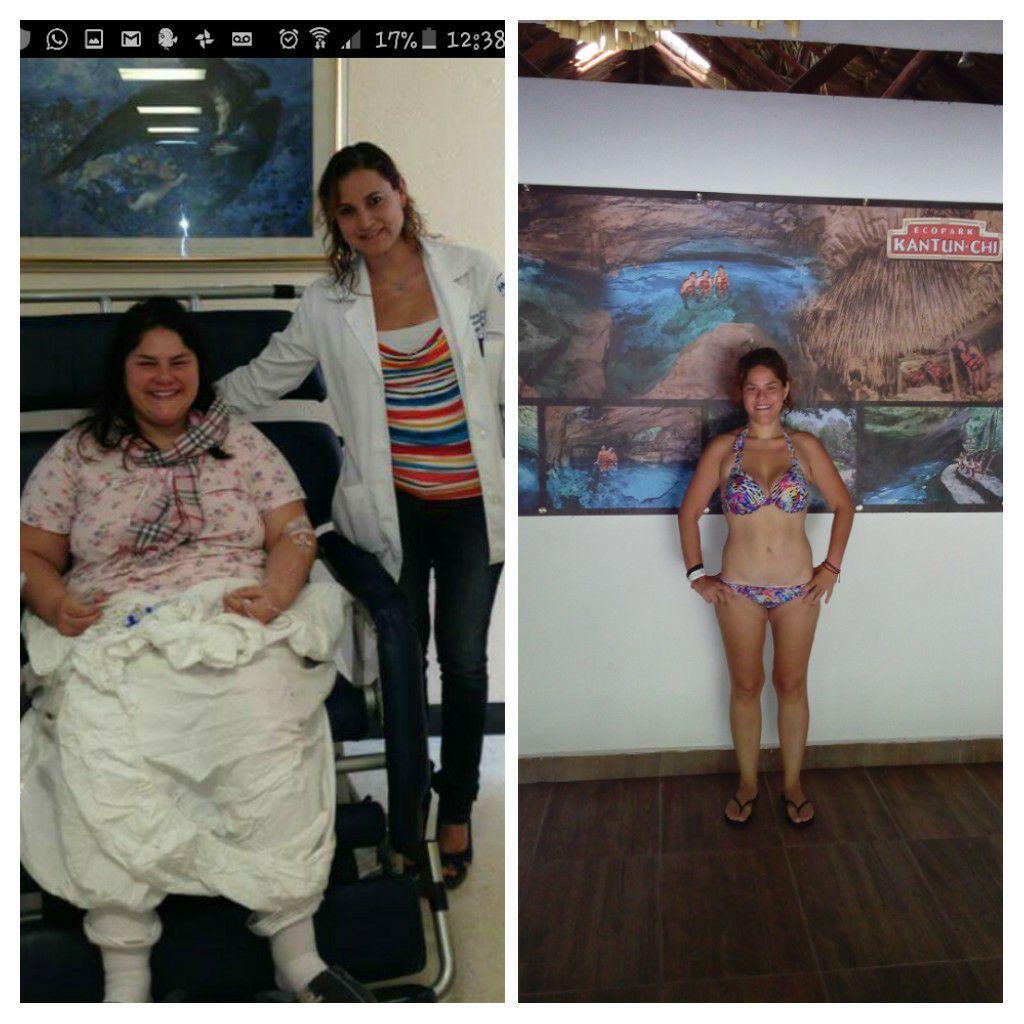 Comparativa antes y después de seguimiento médico