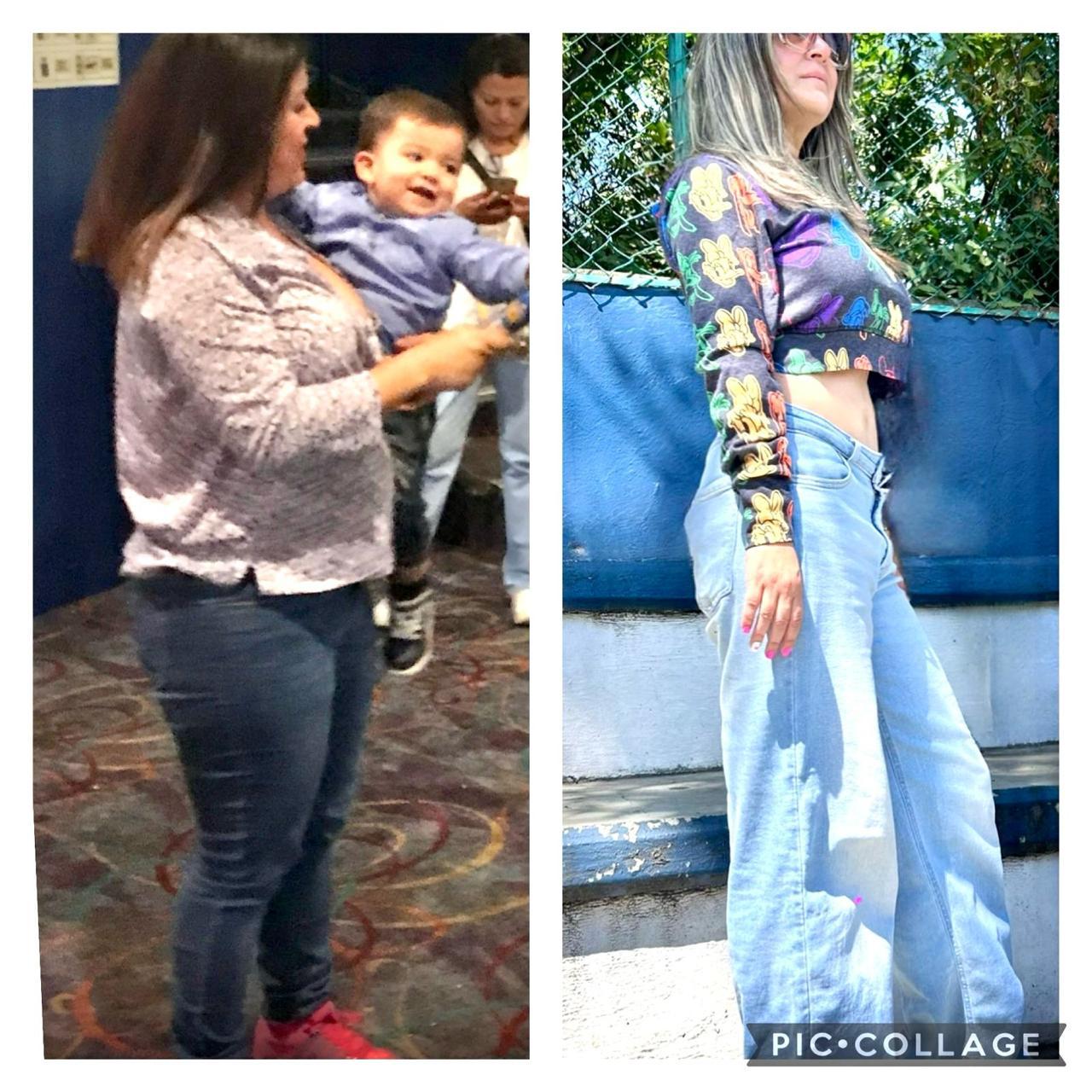 Comparativa antes y después de tratamiento integral
