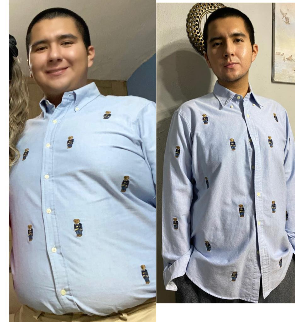 Comparativa antes y después de seguimiento especializado